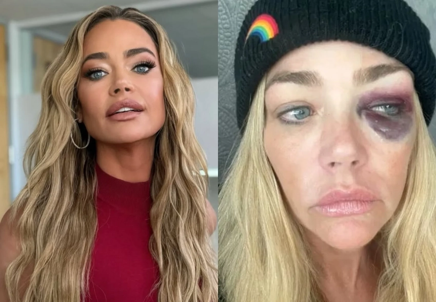 "Душил меня и угрожал убить". Дениз Ричардс обвинила мужа в домашнем насилии